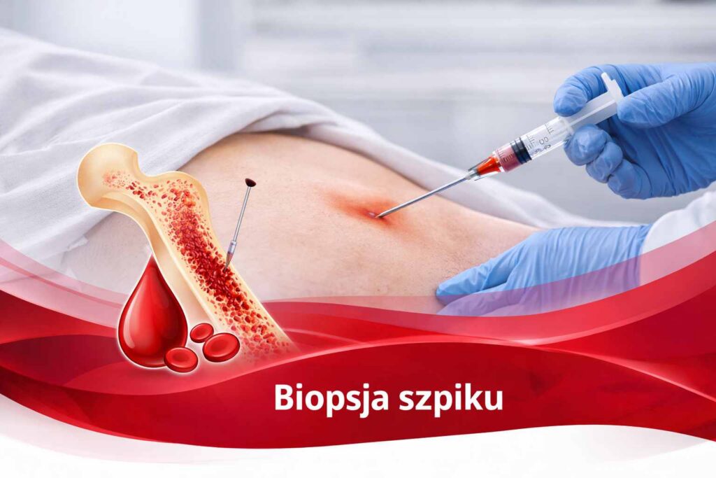 biopsja